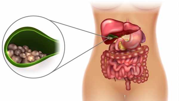 Как болит желчный пузырь