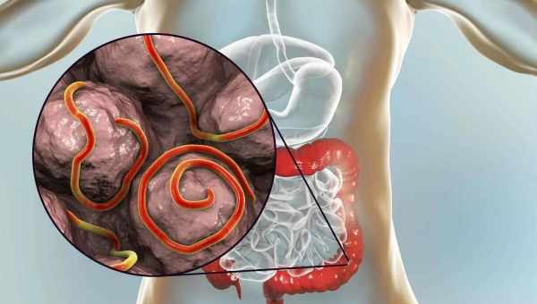 Как избавиться от паразитов в организме