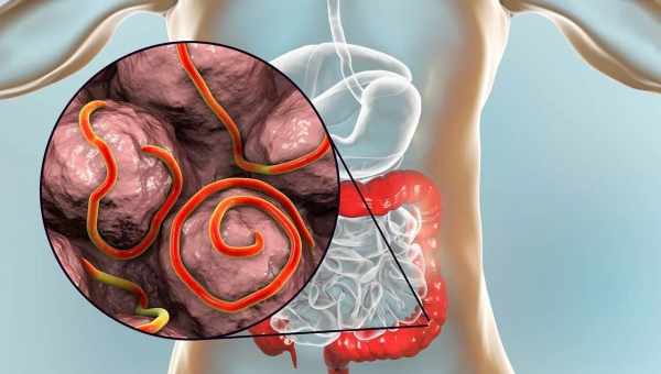 Как определить паразитов в организме