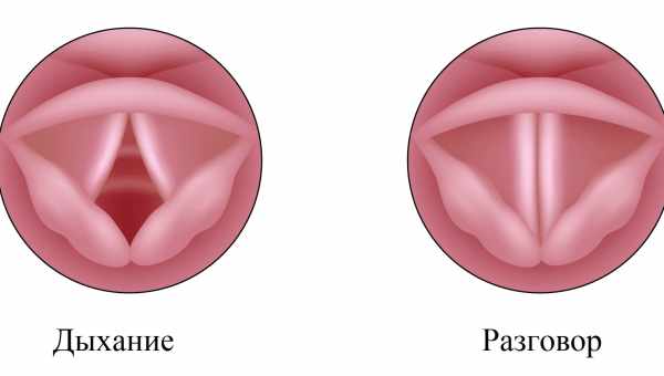 Как лечить голосовые связки