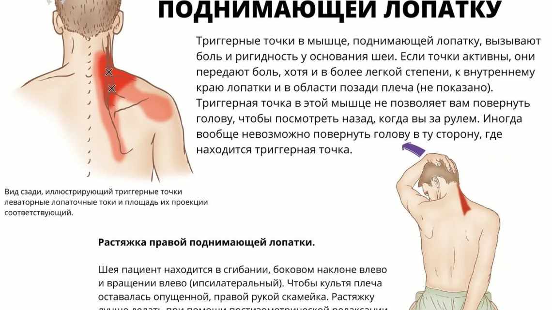 Травма, менингит и даже инфаркт: почему болит шея, что делать, чтобы убрать боль