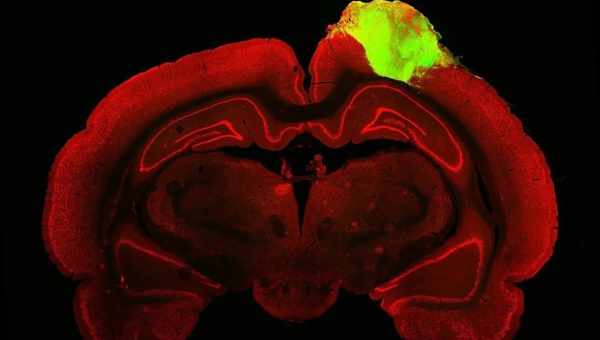 3D-модель мозга мыши увеличит темп научных исследований